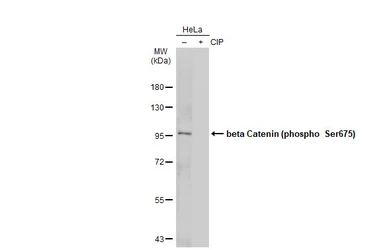 Anti-beta Catenin (phospho Ser675) antibody used in Western Blot (WB). GTX132611