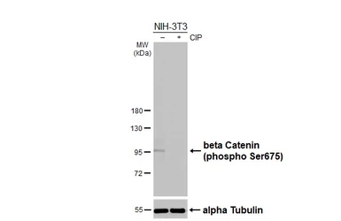 Anti-beta Catenin (phospho Ser675) antibody used in Western Blot (WB). GTX132611