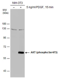 Anti-AKT (phospho Ser473) antibody used in Western Blot (WB). GTX132615