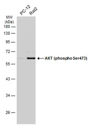 Anti-AKT (phospho Ser473) antibody used in Western Blot (WB). GTX132615