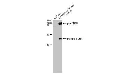 Anti-BDNF antibody used in Western Blot (WB). GTX132621