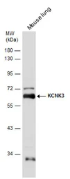 Anti-KCNK3 antibody used in Western Blot (WB). GTX132622