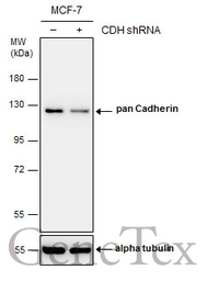 Anti-pan Cadherin antibody used in Western Blot (WB). GTX132646