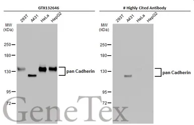 Anti-pan Cadherin antibody used in Western Blot (WB). GTX132646