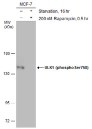 Anti-ULK1 (phospho Ser758) antibody used in Western Blot (WB). GTX132654
