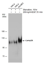 Anti-LAMP2A antibody used in Western Blot (WB). GTX132655