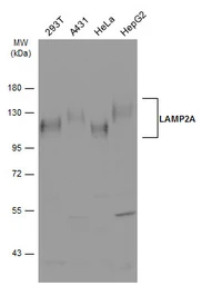 Anti-LAMP2A antibody used in Western Blot (WB). GTX132655