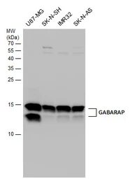 Anti-GABARAP antibody used in Western Blot (WB). GTX132657