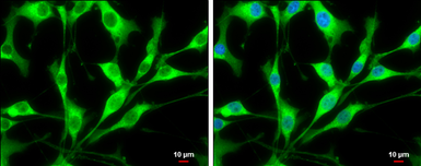 Anti-GABARAP antibody used in Immunocytochemistry/ Immunofluorescence (ICC/IF). GTX132657