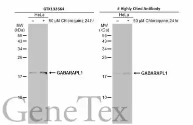 Anti-GABARAPL1 antibody used in Western Blot (WB). GTX132664