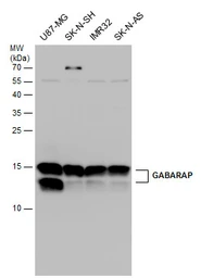 Anti-GABARAP antibody used in Western Blot (WB). GTX132665