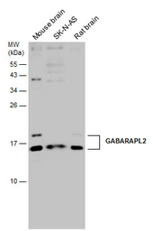Anti-GABARAPL2 antibody used in Western Blot (WB). GTX132666