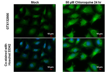 Anti-GABARAPL2 antibody used in Immunocytochemistry/ Immunofluorescence (ICC/IF). GTX132666