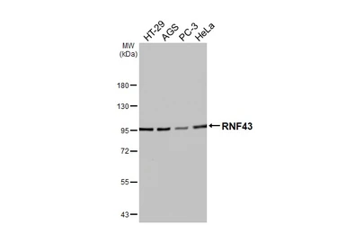 Anti-RNF43 antibody used in Western Blot (WB). GTX132671