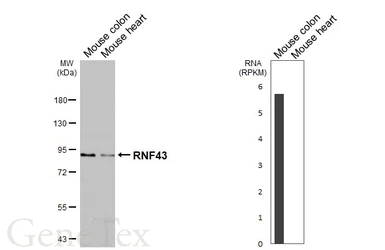 Anti-RNF43 antibody used in Western Blot (WB). GTX132671