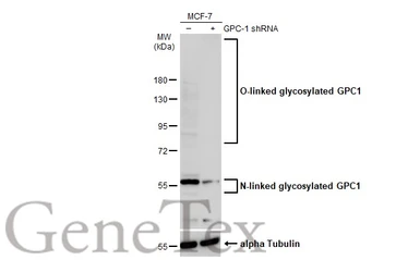 Anti-Glypican 1 antibody used in Western Blot (WB). GTX132672