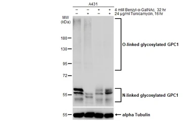 Anti-Glypican 1 antibody used in Western Blot (WB). GTX132672