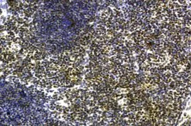 Anti-IL21 Receptor antibody used in Immunohistochemistry (IHC). GTX13268