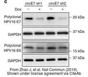 Anti-Human Papillomavirus type 16 E6 antibody used in Western Blot (WB). GTX132686