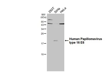 Anti-Human Papillomavirus type 16 E6 antibody used in Western Blot (WB). GTX132686