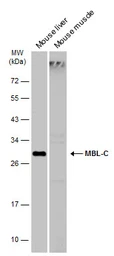 Anti-MBL2 antibody used in Western Blot (WB). GTX132722