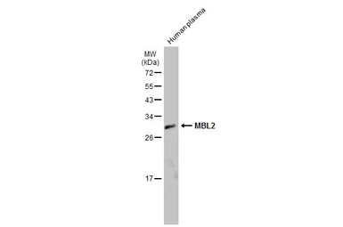 Anti-MBL2 antibody used in Western Blot (WB). GTX132722