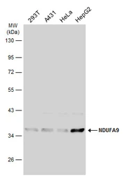 Anti-NDUFA9 antibody used in Western Blot (WB). GTX132726