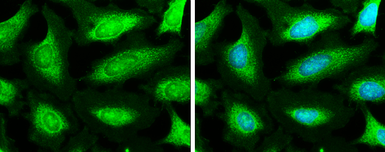 Anti-NDUFA9 antibody used in Immunocytochemistry/ Immunofluorescence (ICC/IF). GTX132726