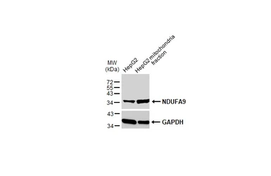 Anti-NDUFA9 antibody used in Western Blot (WB). GTX132726