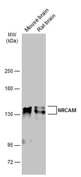 Anti-NRCAM antibody used in Western Blot (WB). GTX132727