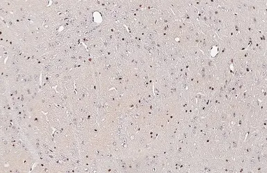 Anti-OLIG2 antibody used in IHC (Paraffin sections) (IHC-P). GTX132732