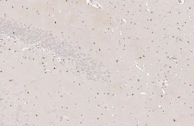 Anti-OLIG2 antibody used in IHC (Paraffin sections) (IHC-P). GTX132732