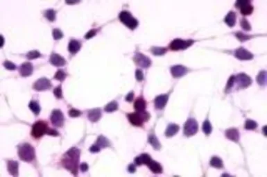 Anti-GPRC5A antibody used in Immunocytochemistry/ Immunofluorescence (ICC/IF). GTX13274