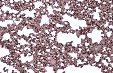 Anti-hnRNP L antibody used in IHC (Paraffin sections) (IHC-P). GTX132754