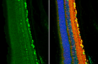 Anti-Parvalbumin antibody used in IHC (Paraffin sections) (IHC-P). GTX132759