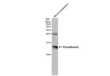 Anti-Parvalbumin antibody used in Western Blot (WB). GTX132759