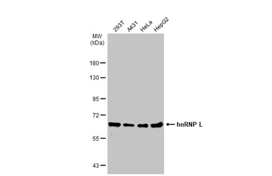 Anti-hnRNP L antibody used in Western Blot (WB). GTX132760