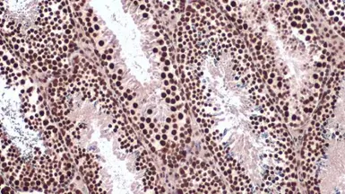 Anti-hnRNP L antibody used in IHC (Paraffin sections) (IHC-P). GTX132760