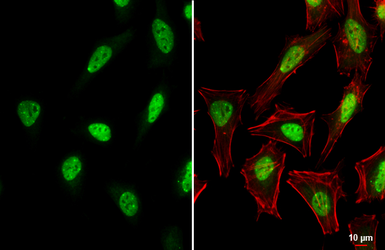 Anti-hnRNP L antibody used in Immunocytochemistry/ Immunofluorescence (ICC/IF). GTX132760