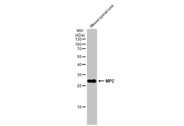 Anti-MPZ antibody used in Western Blot (WB). GTX132761