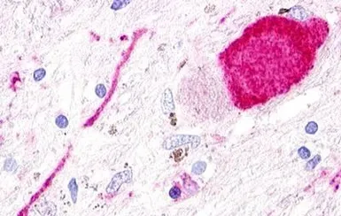 Anti-SREB3 antibody used in IHC (Paraffin sections) (IHC-P). GTX13277