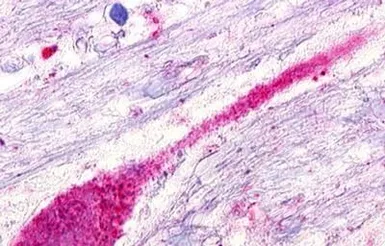 Anti-SREB3 antibody used in IHC (Paraffin sections) (IHC-P). GTX13277
