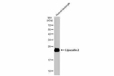Anti-Lipocalin-2 antibody used in Western Blot (WB). GTX132773