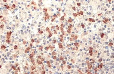 Anti-Lipocalin-2 antibody used in IHC (Paraffin sections) (IHC-P). GTX132773