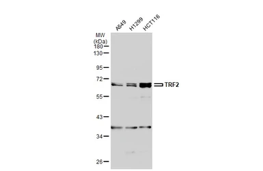 Anti-TRF2 antibody used in Western Blot (WB). GTX132780