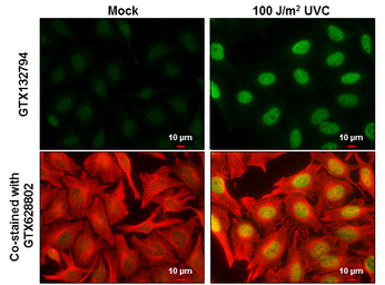 Anti-DNA-PKcs (phospho Ser2056) antibody used in Immunocytochemistry/ Immunofluorescence (ICC/IF). GTX132794