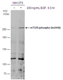 Anti-mTOR (phospho Ser2448) antibody used in Western Blot (WB). GTX132803