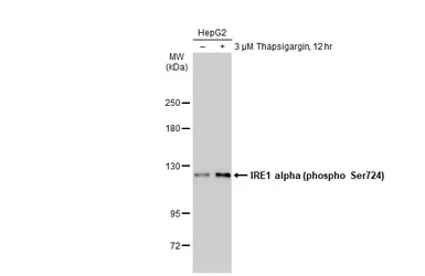 Anti-IRE1 alpha (phospho Ser724) antibody used in Western Blot (WB). GTX132808