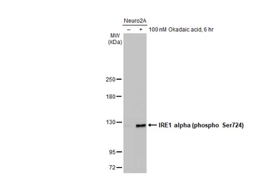 Anti-IRE1 alpha (phospho Ser724) antibody used in Western Blot (WB). GTX132808