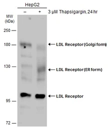 Anti-LDL Receptor antibody used in Western Blot (WB). GTX132861